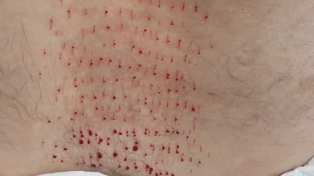 Боль в пояснице хиджама смотреть онлайн