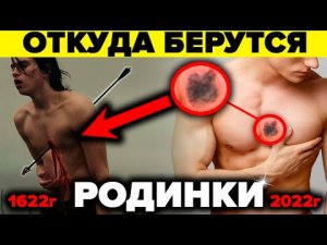 Врачи боятся даже думать об этом! Как Родинки связаны с прошлыми жизнями и причём тут психосоматика?