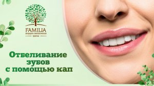 ↪ Отбеливание зубов с помощью кап