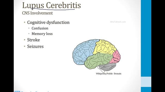 Иммунология USMLE - 4. Аутоиммунные заболевания - 1.Системная Красная Волчанка