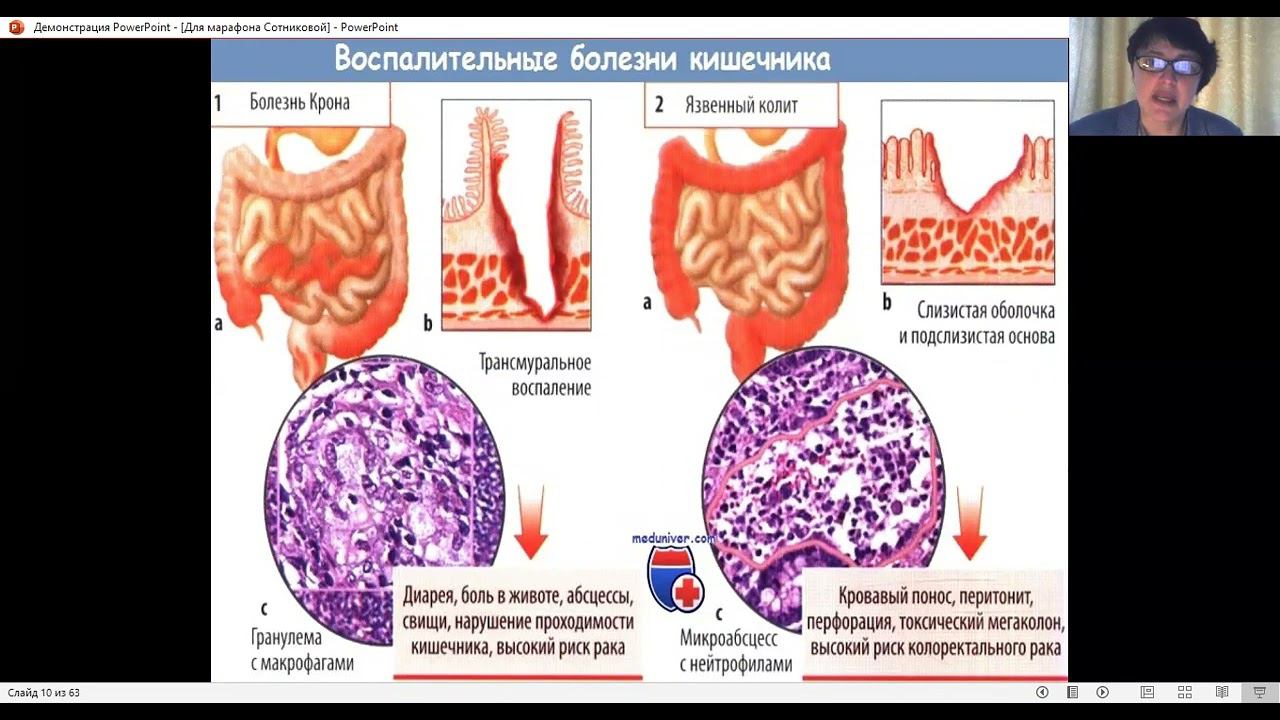 Современные основы и методы восстановления микрофлоры желудочно-кишечного тракта