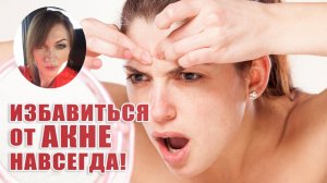 Избавиться от акне навсегда!