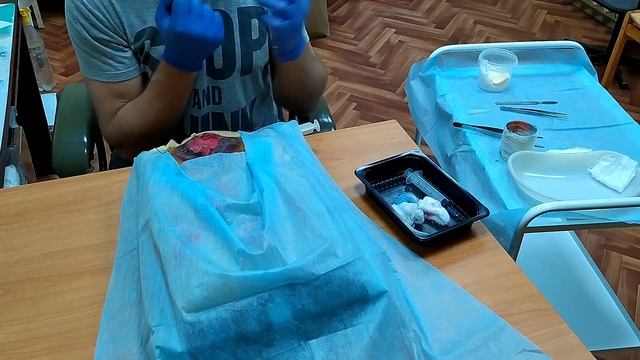 Размозжение конечности. ПХО раны. смотреть онлайн