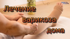 Лечение варикоза в домашних условиях. Доктор по соседству.