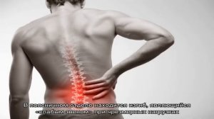 Почему болит спина после сна