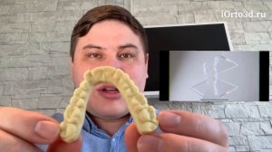 Что такое элайнеры? Как капы выравнивают зубы?