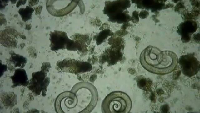 + 18 ДІАГНОСТИКА ТРИХІНЕЛЬОЗУ- навчальний відеофільм РДАК смотреть онлайн