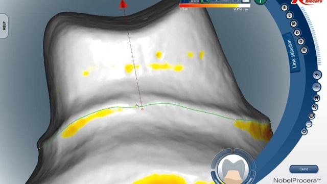 090205 NobelProcera_autoLine_wmv7.wmv смотреть онлайн