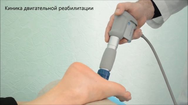 Пяточная шпора, лечение без иньекций, ударно-волновая терапия