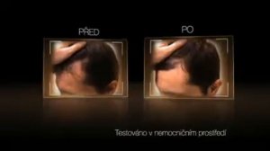 Vichy - Dercos Aminexil