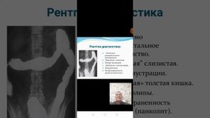 Неспецифический язвенный колит