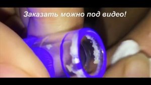 Ультразвуковой очиститель пор