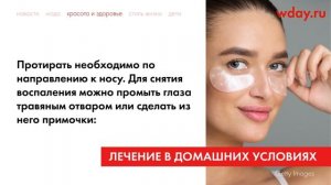 Почему гноятся глаза