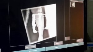 Клинически случай. Перелом лапы у кота