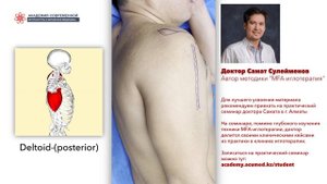 Сухая игла. Deltoid posterior. ДЕЛЬТОВИДНАЯ МЫШЦА. Безопасная постановка иглы.