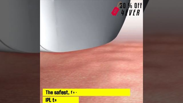 Ultra-Mate IPL Laser hair removal смотреть онлайн