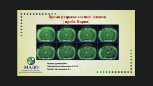 Витальные красители | ВРСП, проба по Норну