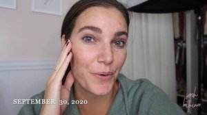 BROW SERUM BEFORE AND AFTER RESULTS | Sarah Brithinee