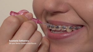 Межзубные ершики: спасители межзубных промежутков