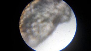 Перхоть под микроскопом