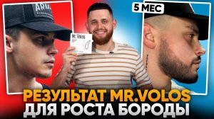 БОРОДА С НУЛЯ ЗА 5 МЕСЯЦЕВ в 24 года / Результаты лосьона mr.Volos для роста бороды