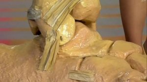 перелом стопы