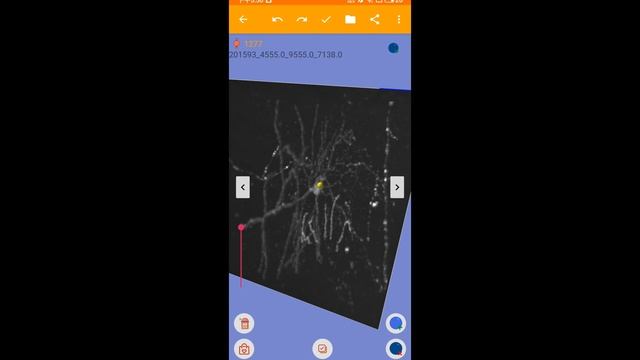 Soma pinpointing using CAR-Mobile смотреть онлайн
