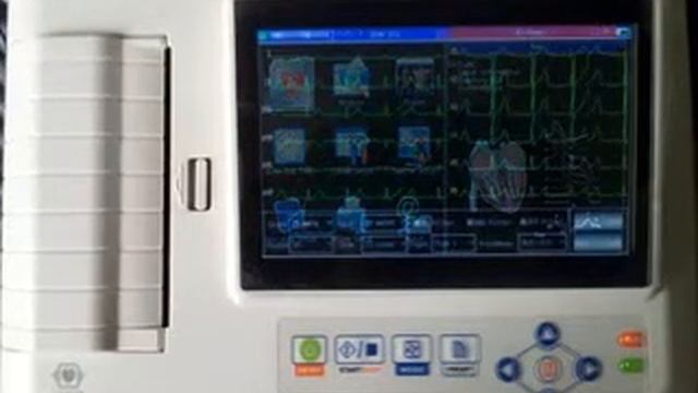 contec ecg machine 600g смотреть онлайн