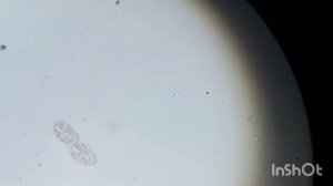 инфузория стилонихия в процессе деления