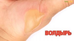 Детский травматизм - Инфоурок