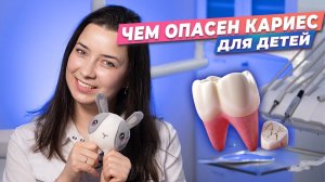 Чем опасен кариес для детей? Причины кариеса у детей. #стоматология #дети #кариес