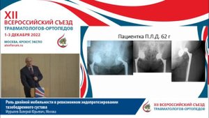 Роль двойной мобильности в ревизионном эндопротезировании тазобедренного сустава