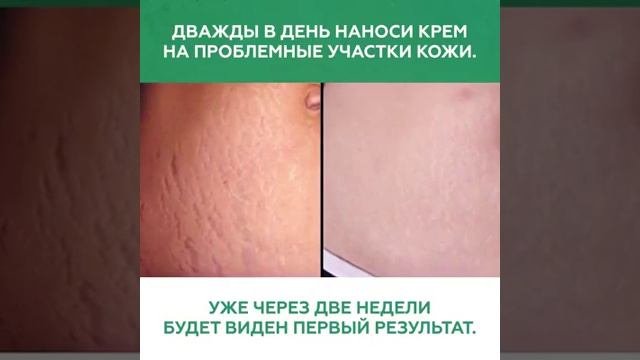 Маски для лица и другое!!!
