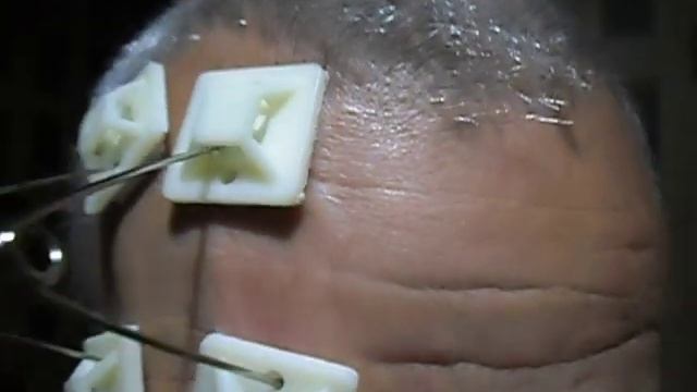 Разглаживаем морщины без ботокса.