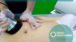 Процедура кавитации зоны живота на аппарате Kim 8 Slimming System