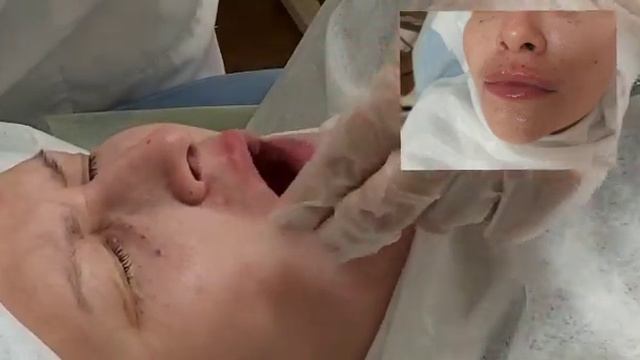 АирисКом студенты учатся: обучение филлеры губы.