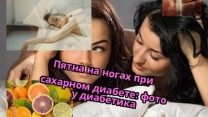 Пятна на ногах при сахарном диабете: фото у диабетика