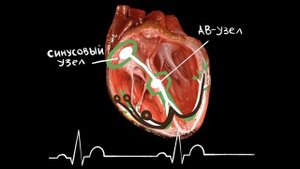 ЖЕЛУДОЧКОВАЯ ЭКСТРАСИСТОЛИЯ / Ж. Т.