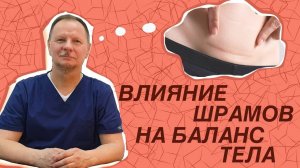 Влияние шрамов на баланс тела.Доктор Кириллов