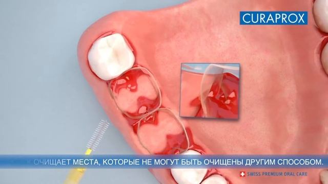 Как правильно пользоваться межзубным ершиком смотреть онлайн