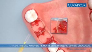 Как правильно пользоваться межзубным ершиком