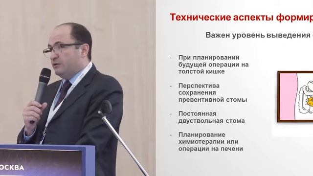Кишечные стомы  показания, технические аспекты, осложнения смотреть онлайн