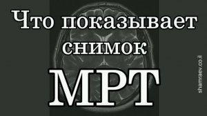 Что показывает снимок МРТ