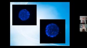 Качество эмбрионов. Выбор оптимального эмбриона для переноса