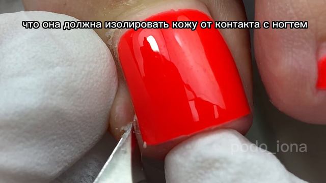 Ошибка в установке тампонады #подология #подологмосква #курсыпедикюра #вросшийноготь #вросшие