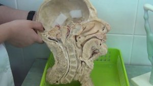 Сагиттальный распил головы, глотка, ротовая полость, полость носа.