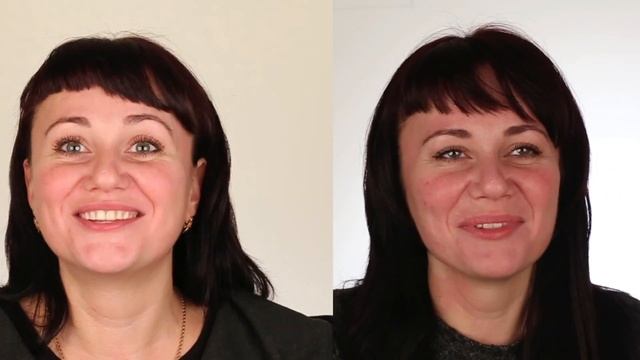Небольшая история преображения улыбки Анны. :)