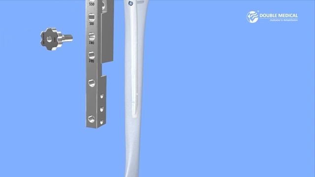 Universal Humerus Nail UHN смотреть онлайн