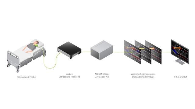 Using NVIDIA Holoscan to Remove Artifacts in Ultrasound Imaging
