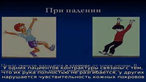 Вывих локтевого сустава